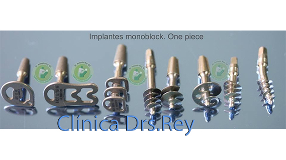 implantes dentales basales 
